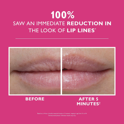 Instant FIRMx Lip Filler|10 ml / 0.3 fl oz