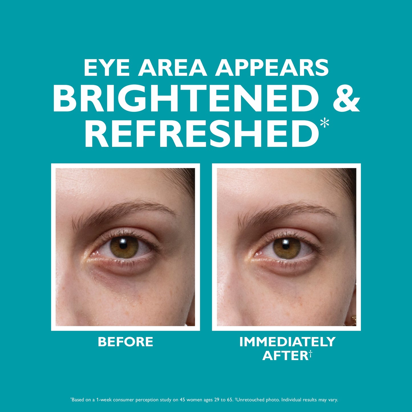 Peptide Skinjection™ Fill + Fix Under-Eye Cream